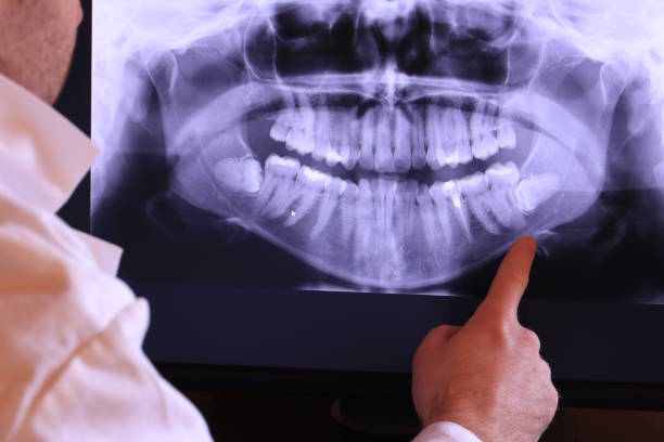 Best Emergency Tooth Extraction in Newman, CA